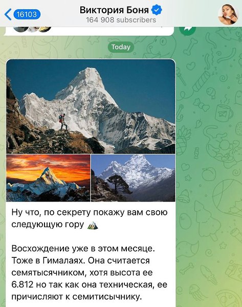 Вика Боня приехала в Москву, чтобы сделать коррекцию губ и лица. Скоро пройдет реабилитация, и она ... - 2