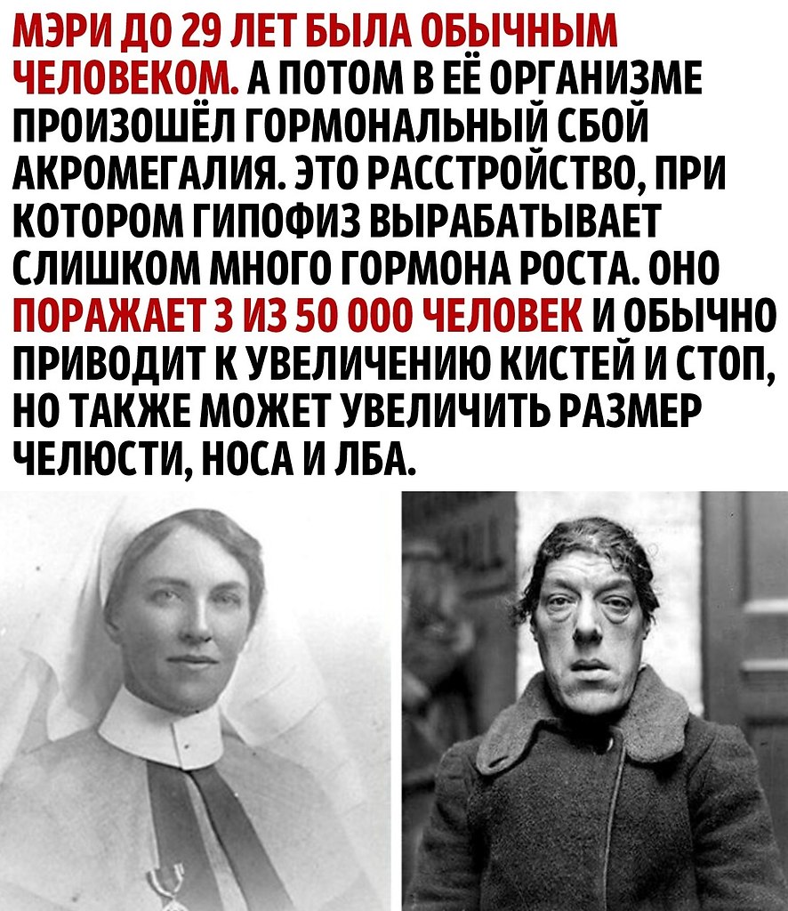      - 2