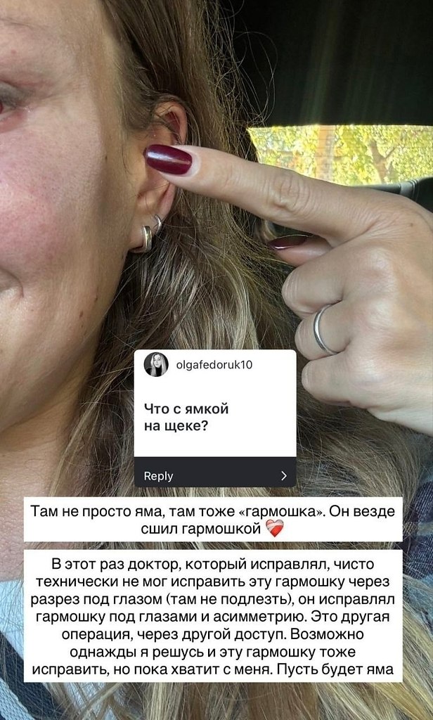 ���� ������ �������� ���� ����� ��������� �������� �� ������. ���������� ������ ������ ������� ... - 3