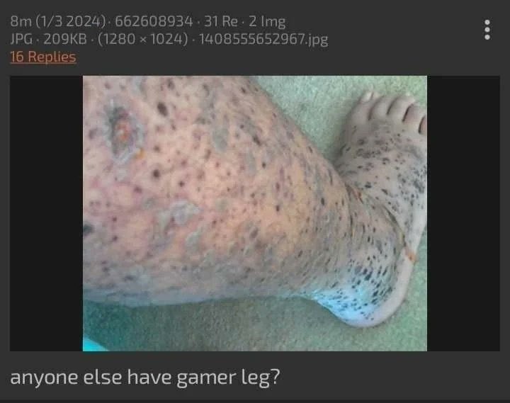 ����� Fortnite ��� ����� TernsCheese ����� � ������� ����� ��������� ������� ���������. ��� ... - 4