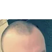 ������� ���������, 45 ���, �����������