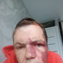 , 37, 