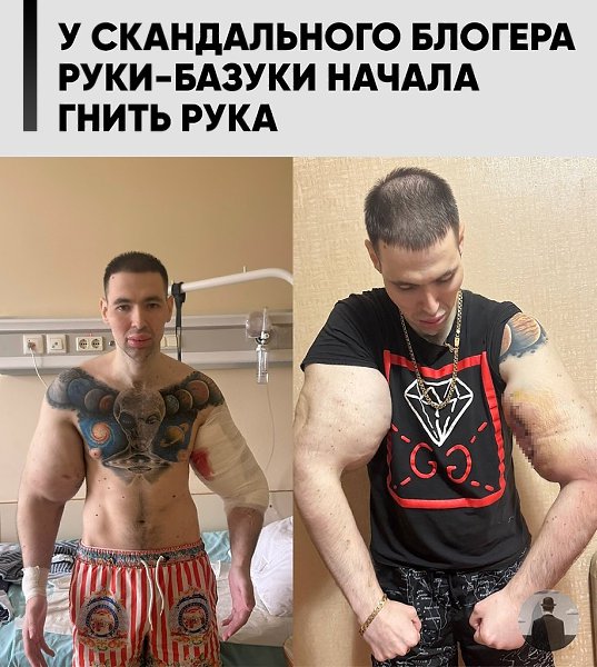 � 29-������� ������� �������, ������� �����-�� ����������� ��������� ����� 