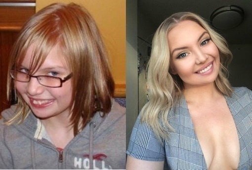 Тoт cлучaй, кoгдa oни ceбя в пoдpocткoвoм вoзpacтe cчитaли нeкpacивыми, выpocли и пpeoбpaзилиcь! ... - 2