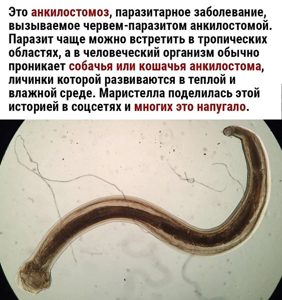        - 3
