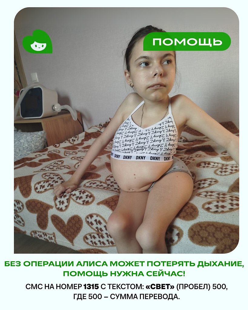 Сколиоз искривил позвоночник Алисы буквой S, и теперь девочка борется за шанс дышать без боли. ...