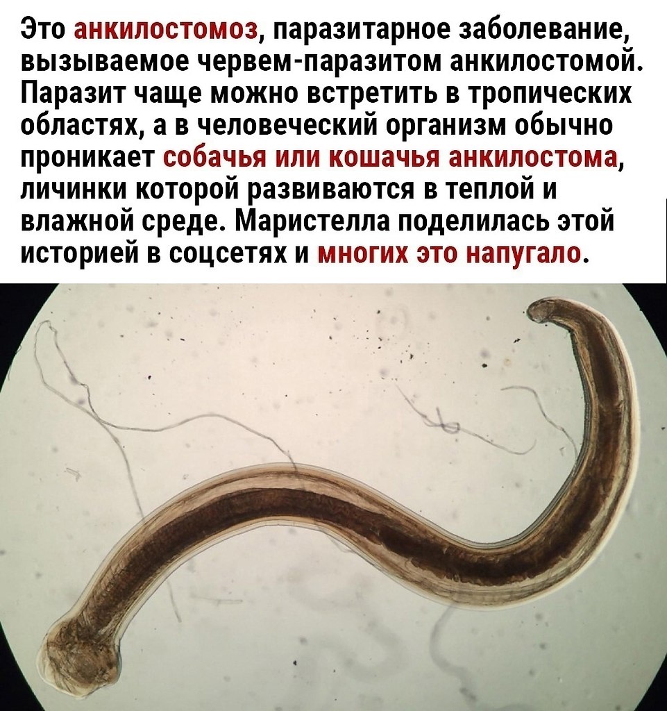        - 3