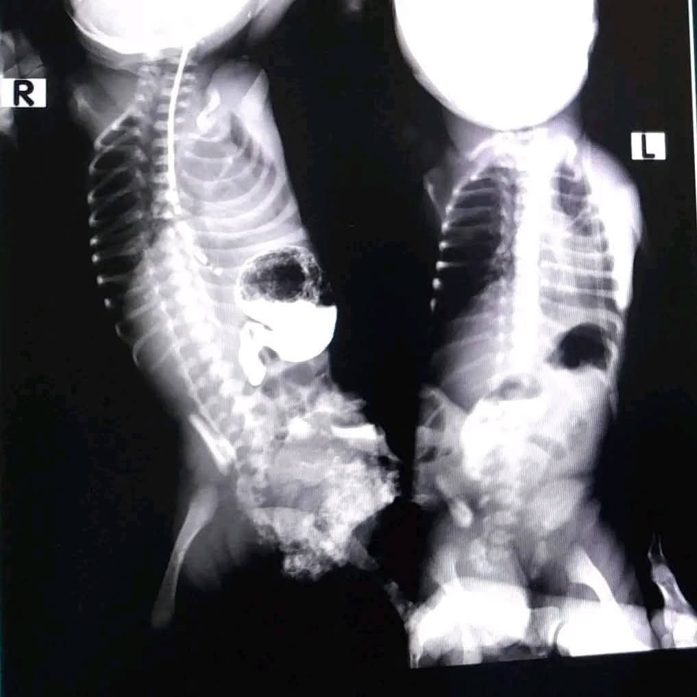 :)     ! 25  2025     ... - 4