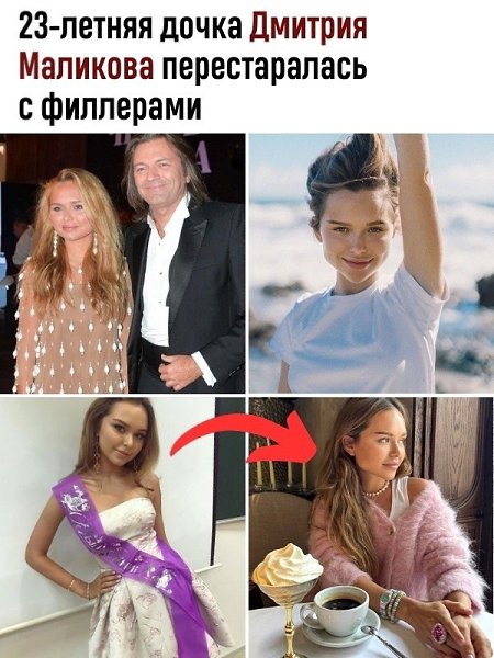 Стефания, по-видимому, неудачно выбрала косметолога, ведь ее подбородок выглядит слишком острым и ...
