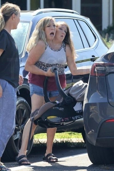 Сиамские сестры-близнецы Хенсел стали мамами.34-летние американские близнецы Эбигейл и Бриттани ... - 3