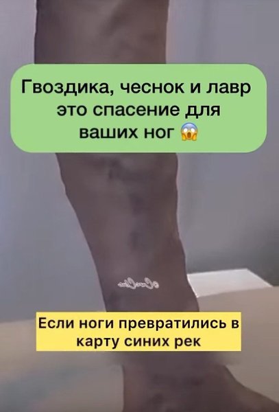Спасение для ваших ног. Сохрани, чтобы не потерять, и не забудь подписаться
