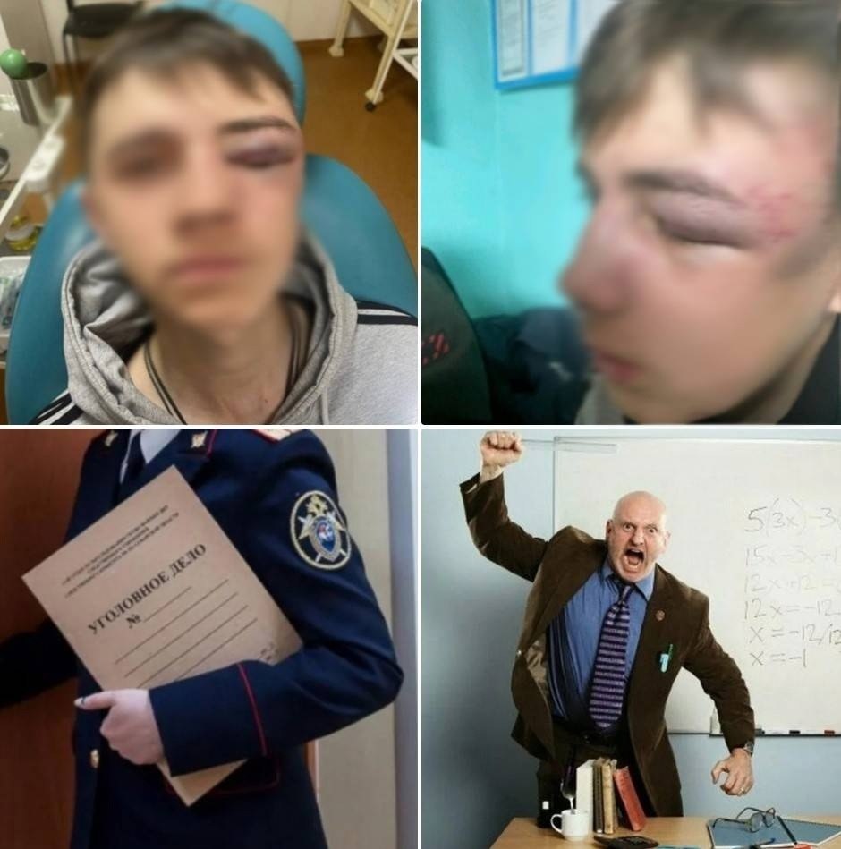 Учитель избивает школьника. В Приморье ученик избил учителя. Разбитый нос школьнику после забива.