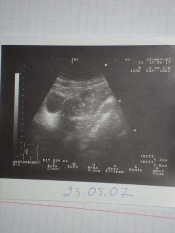     ?     68   22        ... - 2