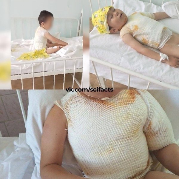 В Якутии 8-летний мальчик попытался поджечь ребенка на детской площадке.Между игравшими детьми ...