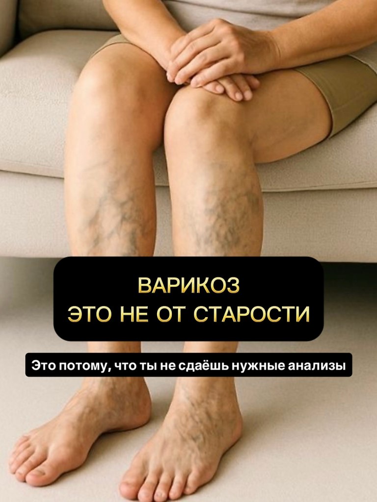 Следите за своими ножками