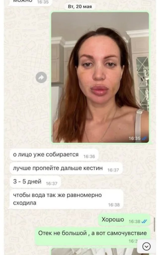   ,     ,     .    ... - 2