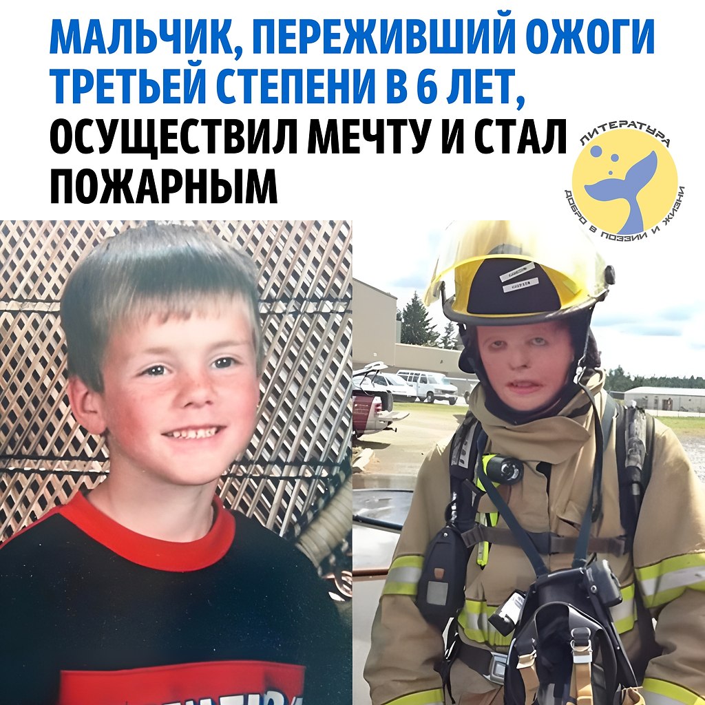 Терри Маккарти, который в 6 лет получил ожоги третьей степени 70% тела, превратил свой ...