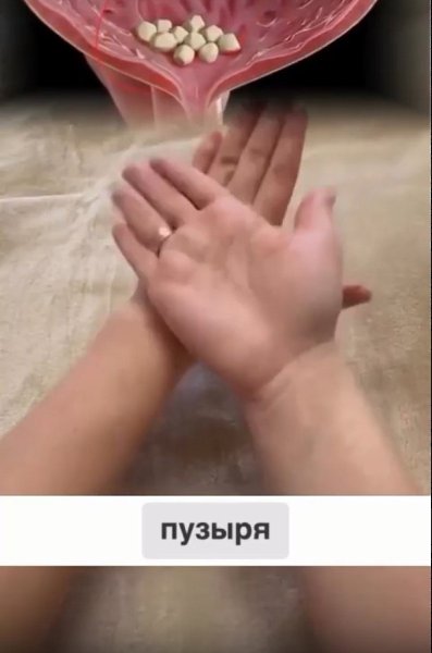        !   ... - 2