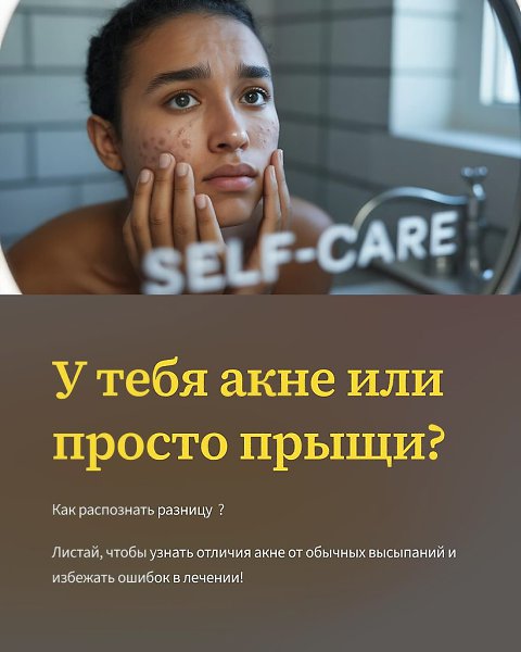 Aкне — хроническое , генетическое заболевание кожи c множественными воспалениями , комедонами и ...