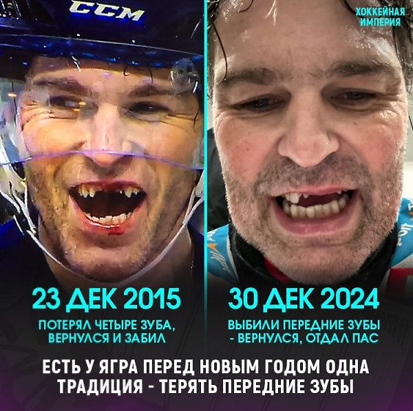 Яромир Ягр лишился почти всех передних зубов.Накануне в матче чемпионата Чехии52-летний Ягр потерял ...