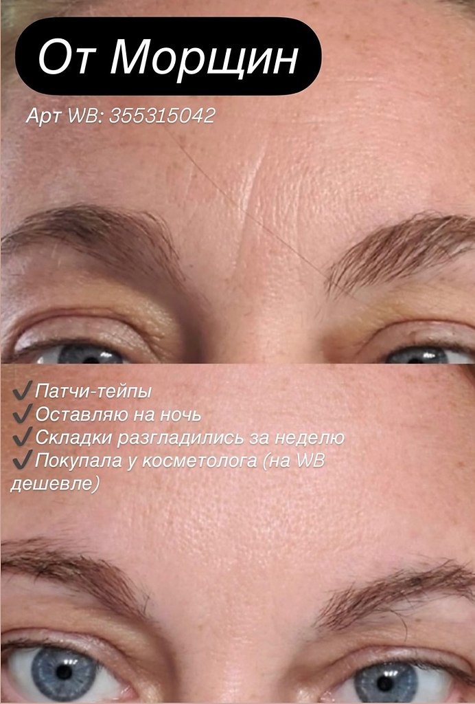 ������ �� WB: https://fotostrana.ru/away?to=/sl/Gur5