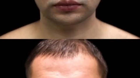 Мужчина обратился к специалисту по пластической хирургии с целью изменить свою внешность и стать ...