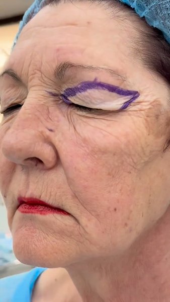 Что только женщины не делают, лишь бы выглядеть лучше... - 2