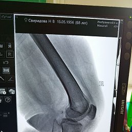 ������� ���������, ������, 66 ���