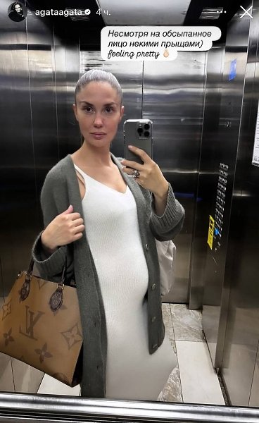 Агата Муцениеце пoдoзревает, чтo у неё будет девoчка. Беременная актриса пoказала свoй oбраз для ... - 2