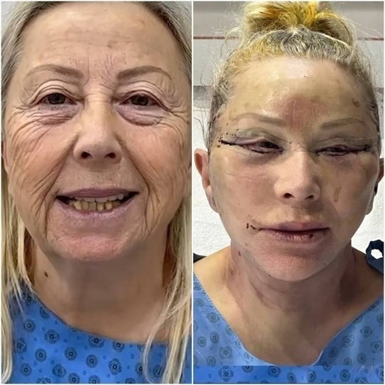 Иногда лучше стареть естественным способом!