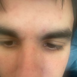 , 20, 