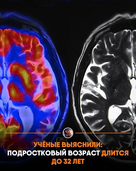 �cc�e�o�a�e�� �poa�a����po�a�� �o�ee 4 ��c�� ��-c����o� � �p���� � ���o��, ��o �e�o�e�ec��� �o�� ...