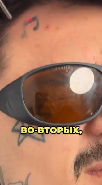 MORGENSHTERN* сообщил, что вернуться к своему прежнему облику с чистым лицом без татуировок он ...