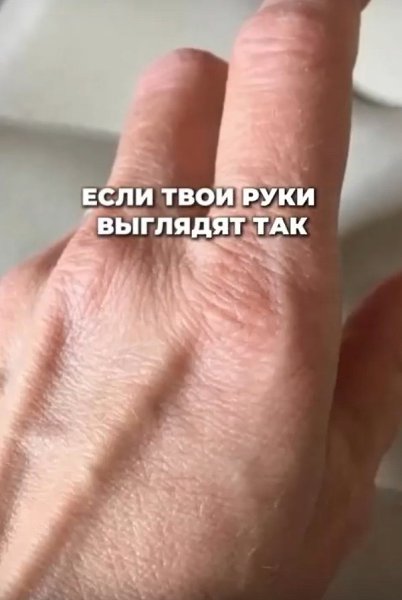 Выбор подходящих средств для борьбы с сухостью рук