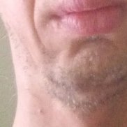 ��������, 35 ���, ������