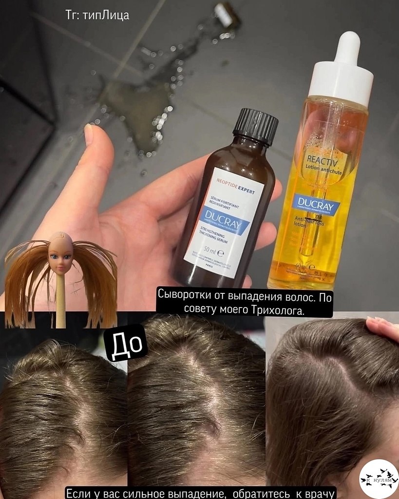 ocea, oopa 10/10.     - 5