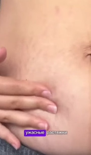 ��� �������� �� �������� ��������� �������! ������ ��� - https://fotostrana.ru/away?to=/sl/pLJ6 - 2