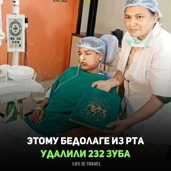 УДАЛИЛИ 232 ЗУБА ИЗ РТА ПАРНЯ.Его зовут Ашик и он живет в Индии, сейчас ему 26 лет, но десять лет ...