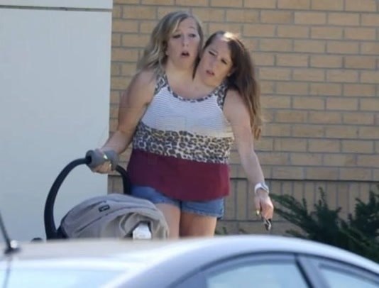 Сиамские сестры-близнецы Хенсел стали мамами.34-летние американские близнецы Эбигейл и Бриттани ... - 2