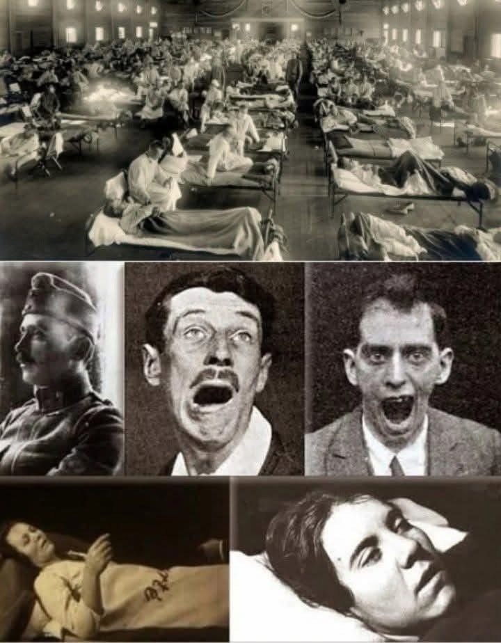  1915  1926     ,      .  ...