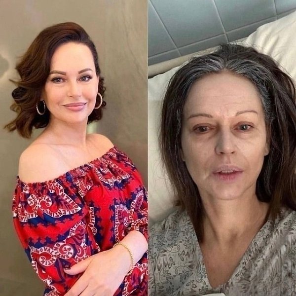 p e pacc   oe ...  2015 o      ...