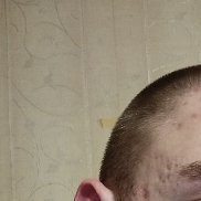 �����, 18 ���, ������