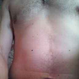 Sen, �����������, 36 ���