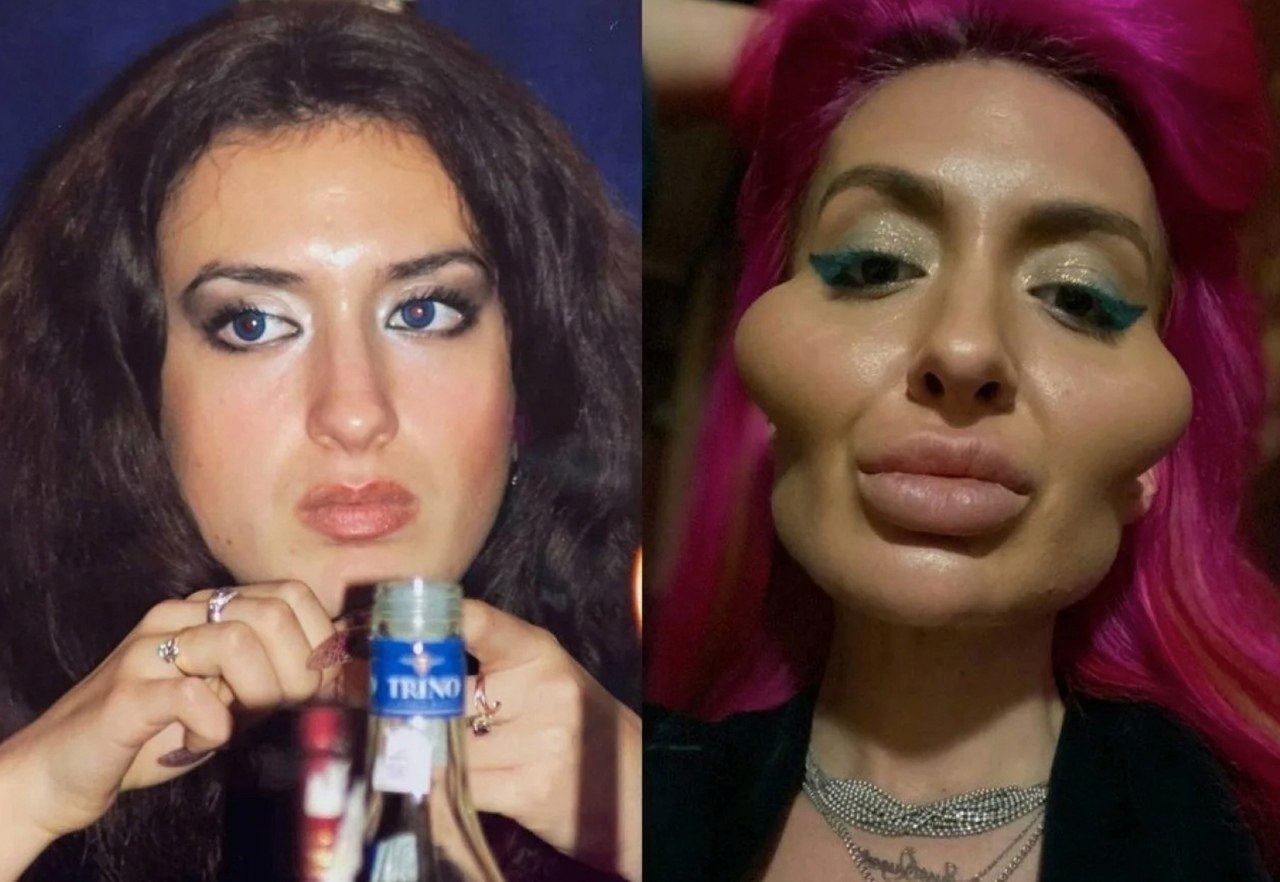        .   ... - 2