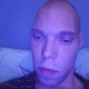 �������, 34 ����, ������