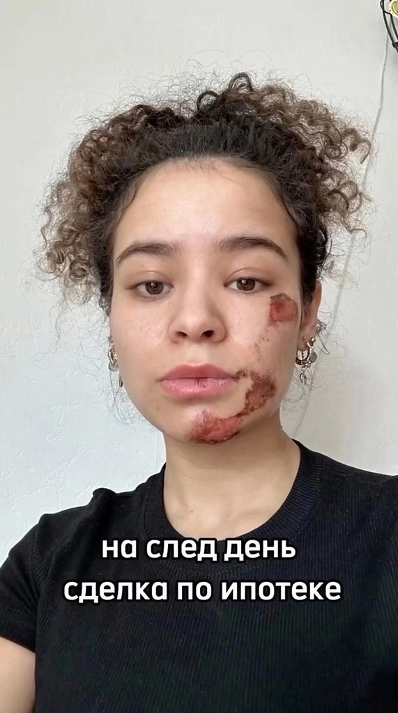       - 2