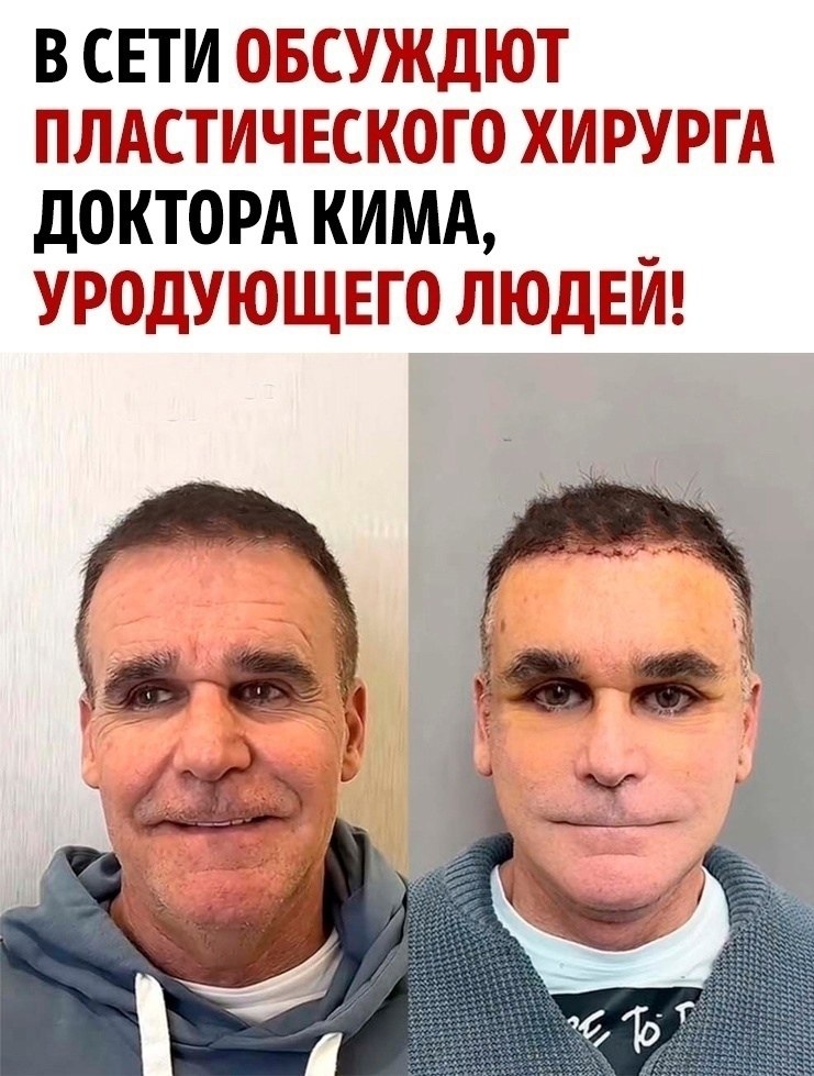 Они хотели быть моложе